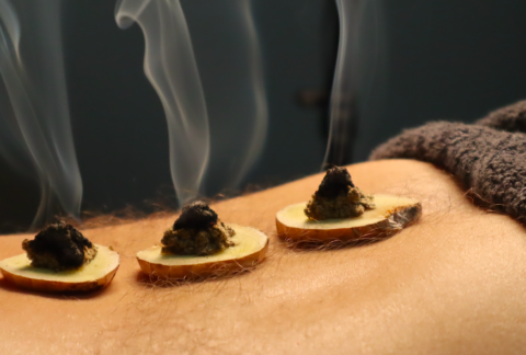 Moxibustion 艾灸