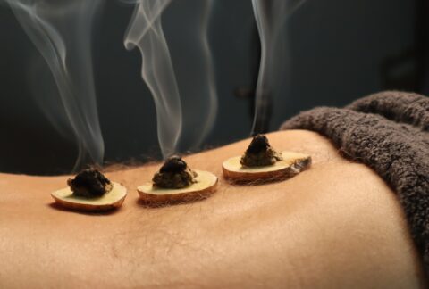 Moxibustion 艾灸